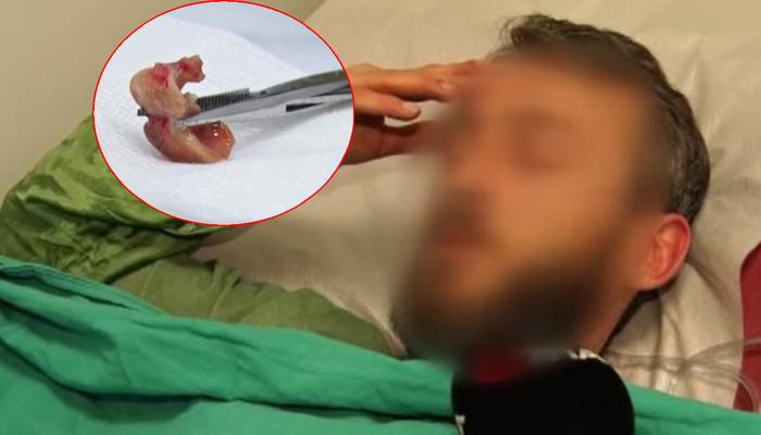 Uykusundan dayanılmaz öksürükle uyandı, aynaya bakınca şok oldu! İlginç olay gece uyurken olmuş